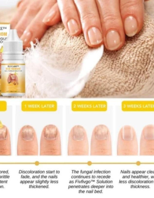 BeeVenom Nail Fungus Solution 15ml Each (Pack of 2)